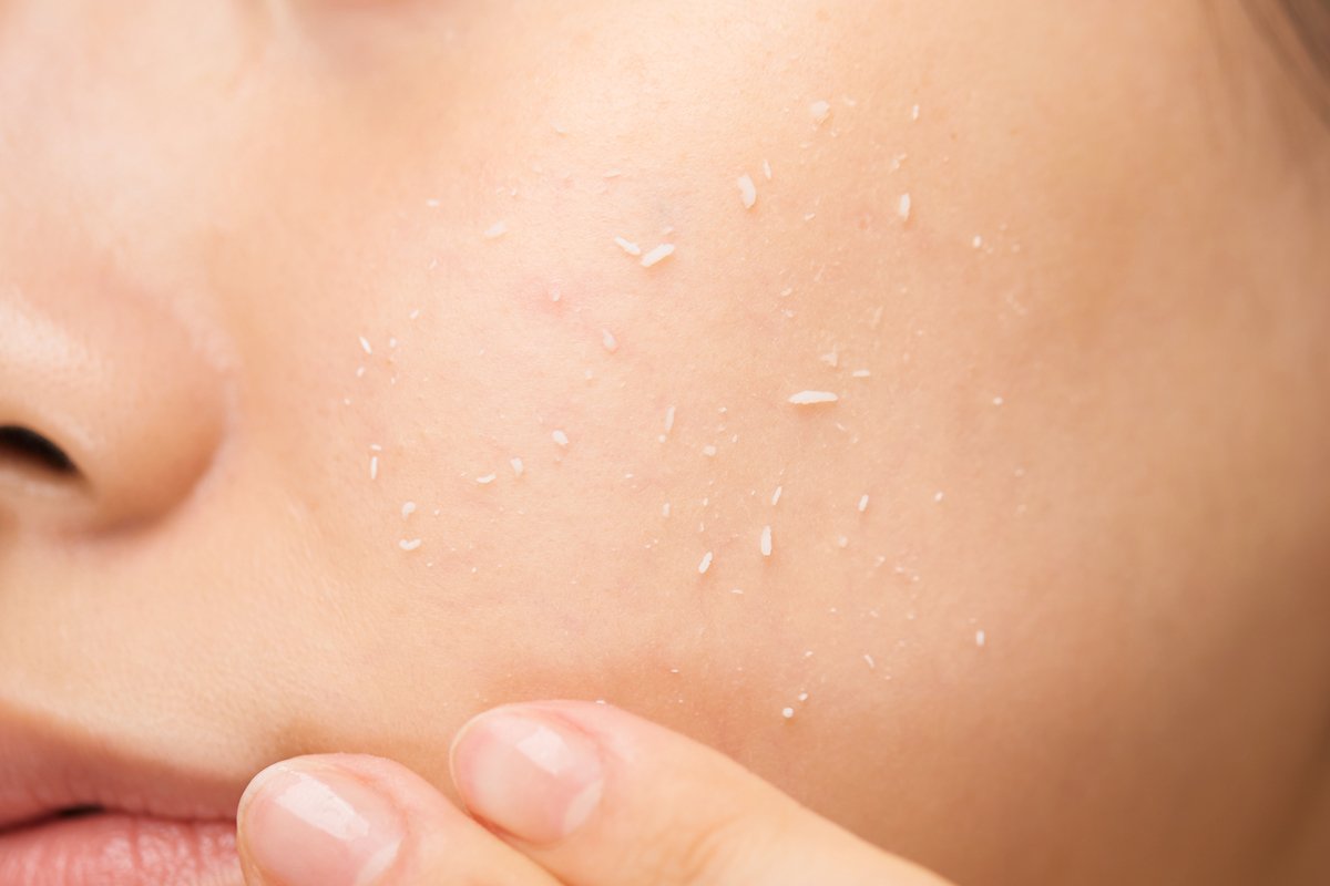 Vitapair C Peeling Gel-3